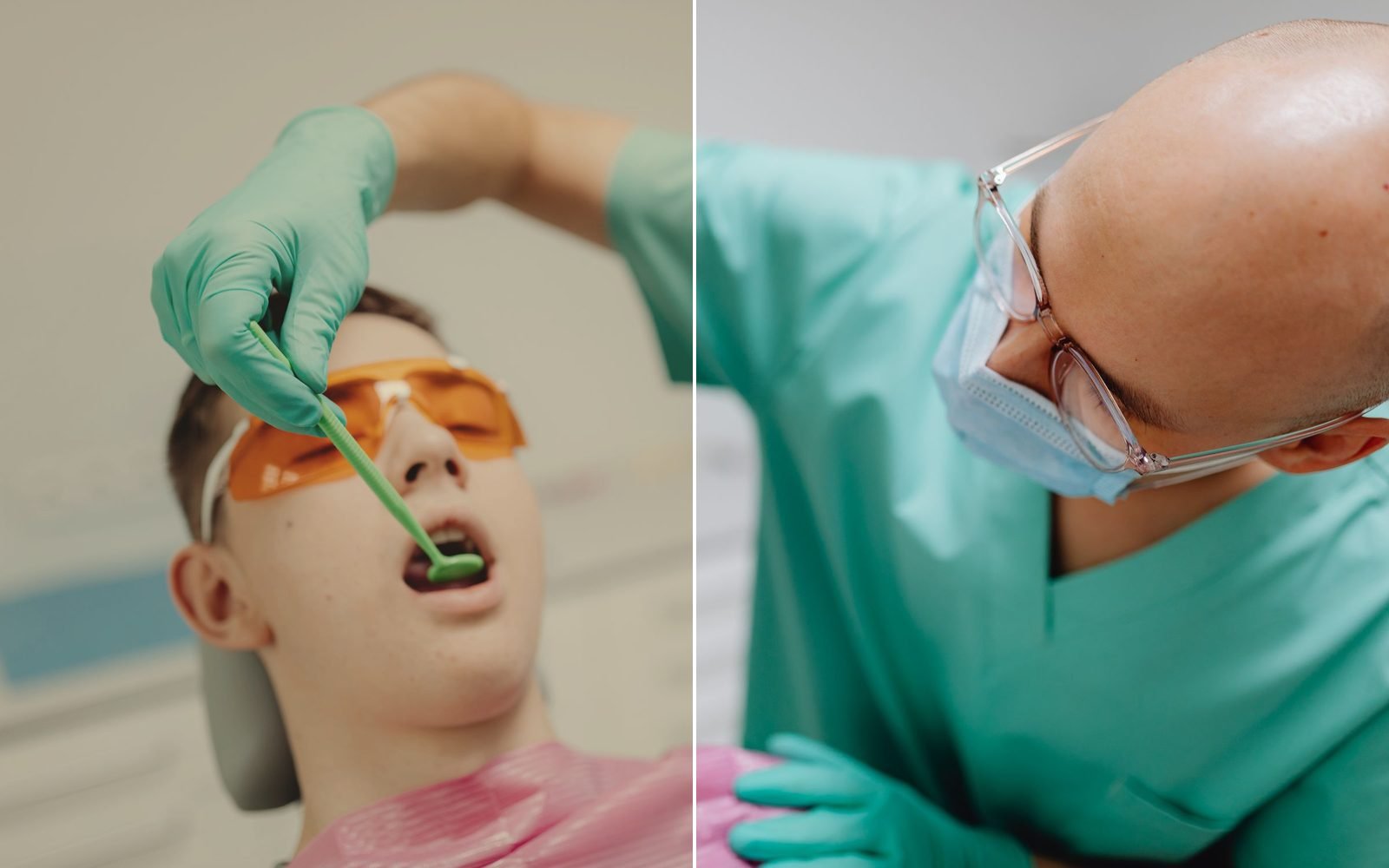 Anterior veneers
